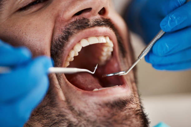 Best Broken Tooth Emergency  in Tyndall, SD